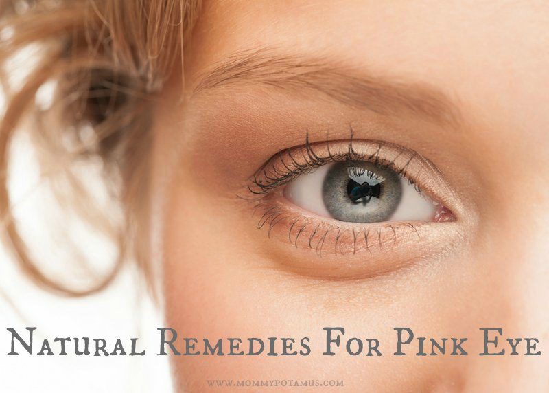 Natural Remedies For Pink Eye 