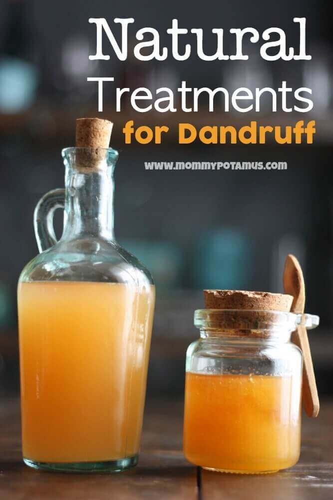 Natural Treatments For Dandruff