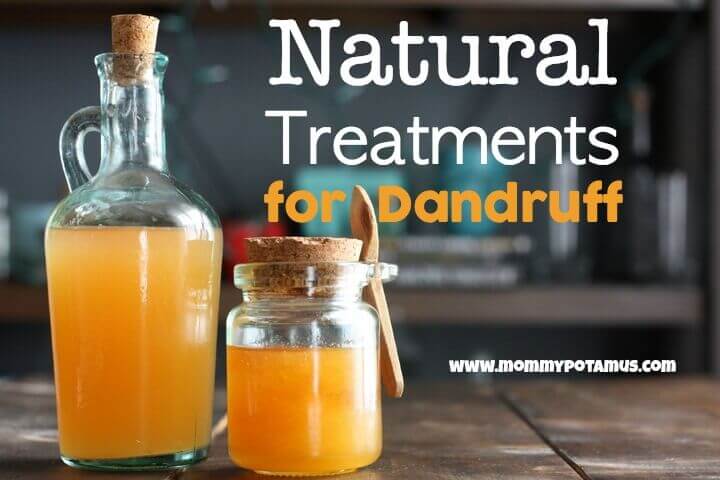 Natural remedies to get rid of dandruff