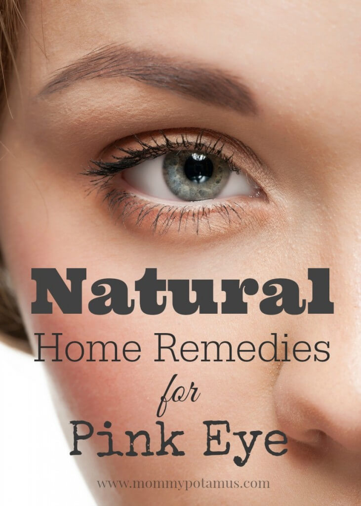 Natural Home Remedies for Pink Eye - Inflamed, crusty eyes? Here are 5 home remedies moms swear by. Plus the difference between viral, bacterial, and allergic pinkeye. 