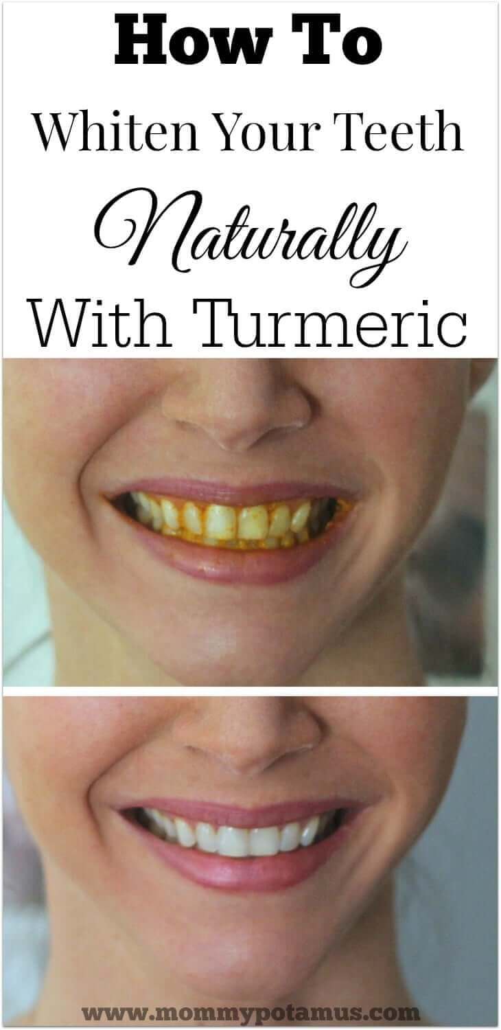 toothpaste and turmeric for teeth whitening