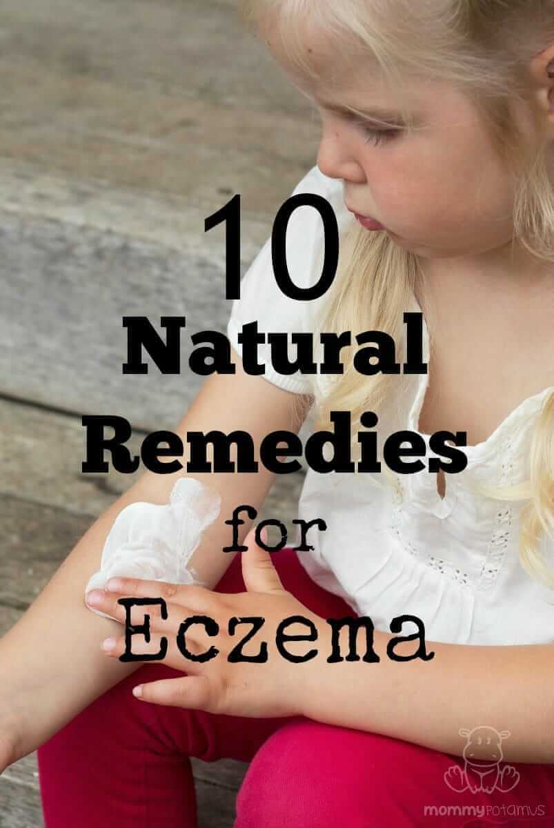 10 Natural Remedies For Eczema 