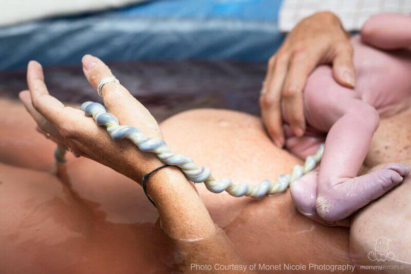 Cutting the umbilical cord after the placenta is delivered