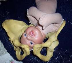 Asynclitic Posterior Doll