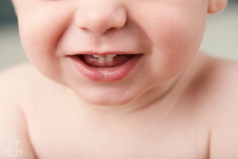diaper rash causes treatment teething